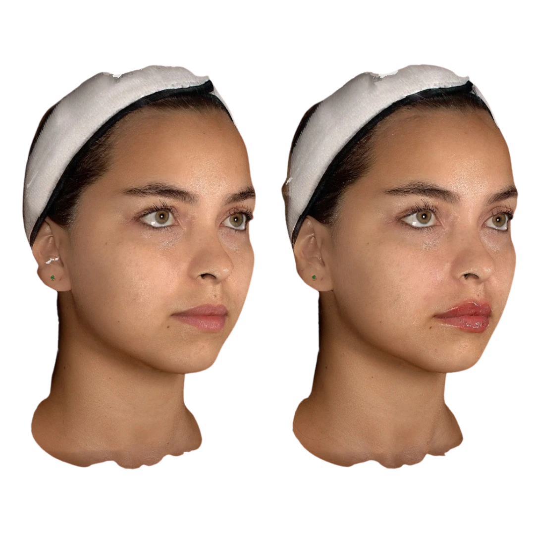 HIDRATACIÓN DE LABIOS